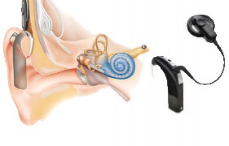 4 Yaşına Kadar Yapılabiliyor!