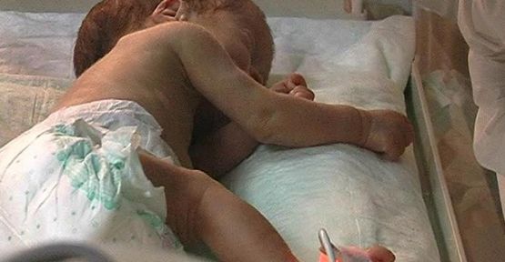 Anne Karnındaki Bebeğe Kan Nakli Yapıldı!