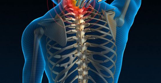 Boyun Ağrısının Nedeni Olabilir!