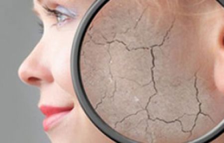 Cilt Kuruluğundan Kurtulmanın Yolları!