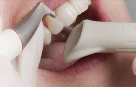 Diş Hekiminden Kanser Hastalarına Tavsiye!