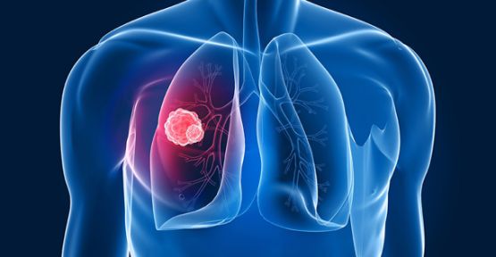 Hedefe Yönelik Tedavi Umudu!