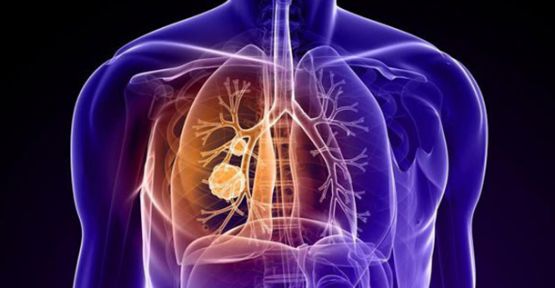 KOAH Belirtilerini Önemseyin!