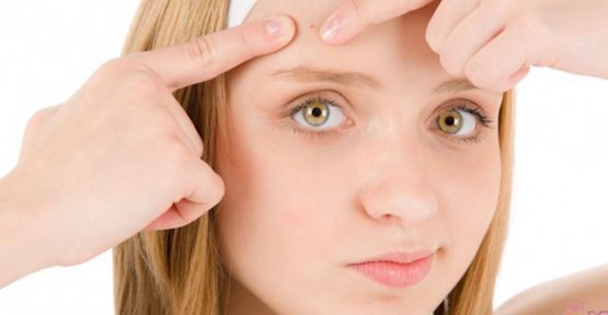 Sivilceden Kurtulmanın Yolları!