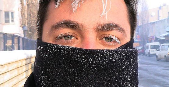 Soğuk Havada Yüz Felcine Dikkat!