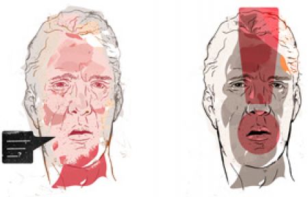 Tedavi Edilmezse Yaşlanmayı Hızlandırıyor!