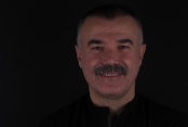 Yirmilik Diş Tehlikesi: Zamanında Çekilmeyen Dişler Gülüş Estetiğini Bozabilir!