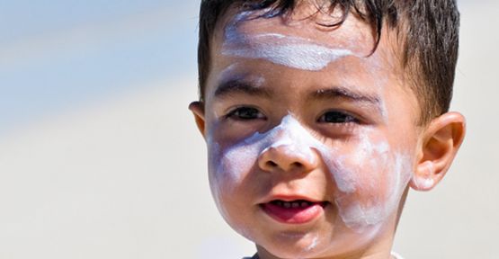 Yanıklara Yoğurt Sürmeyin!